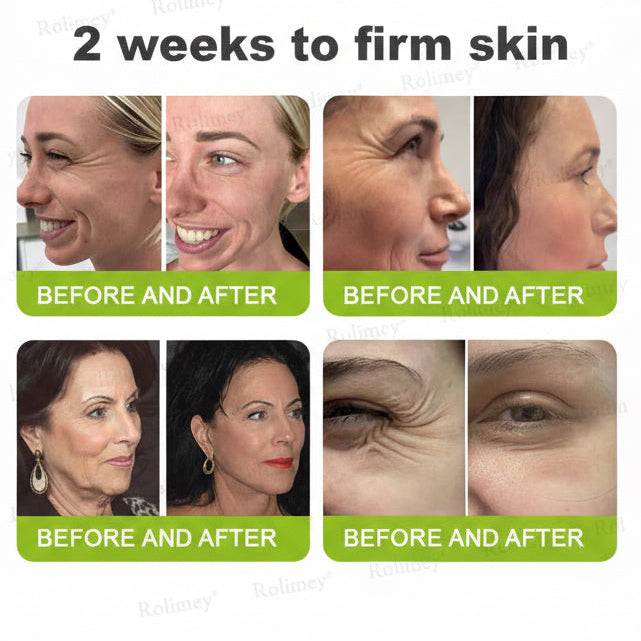 VitaLift™ Retinal Tightening Booster